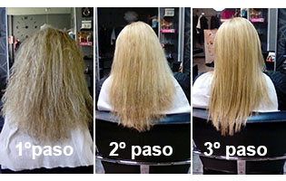 taninoplastia